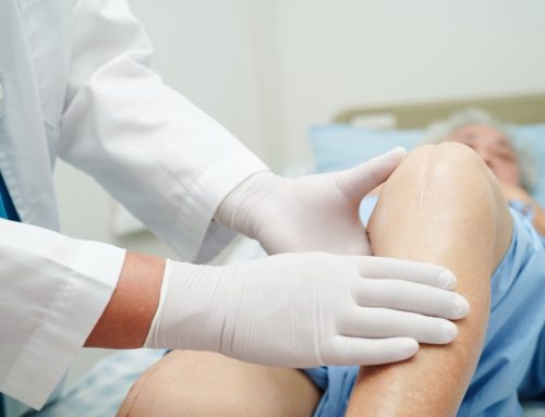 Knee Replacement and Metal Allergy: What You Should Know