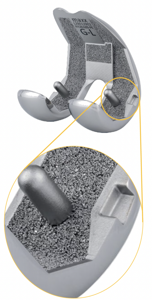 porous-knee-call-out-520×1024