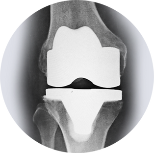 xray